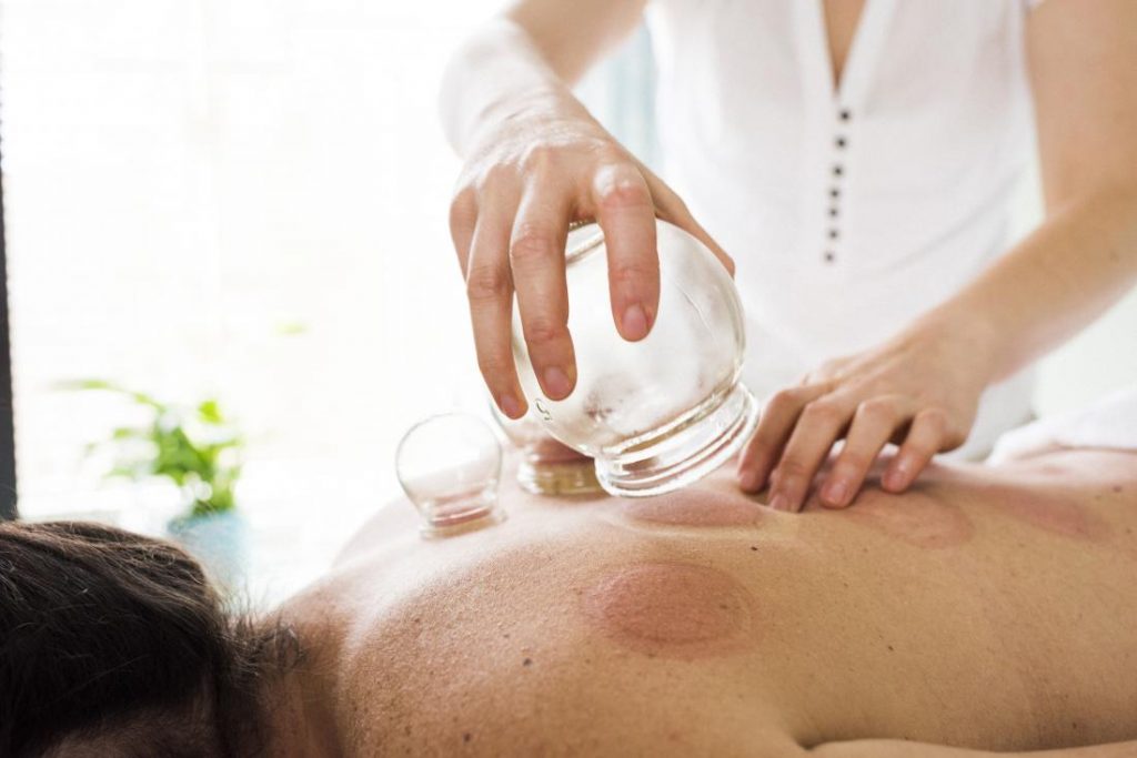 Acupuncture Acupuncture
